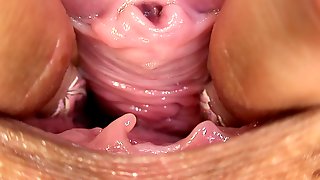 Vagina Sascratchewan