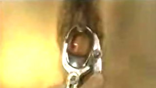 Chinese Mature Gyno  Exam  (loyalsock)